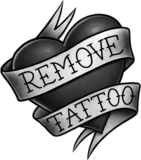 RemoveTattoo